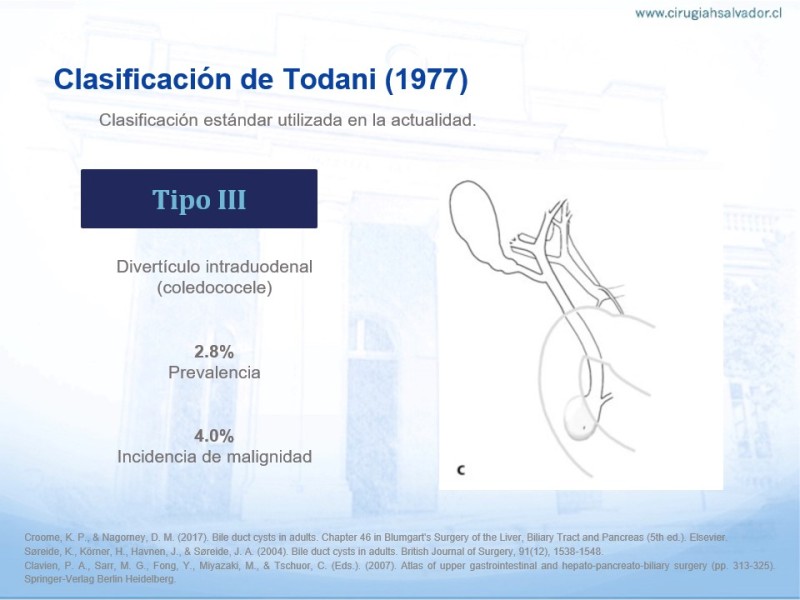 Diapositiva 4 de Quistes de Vía Biliar​