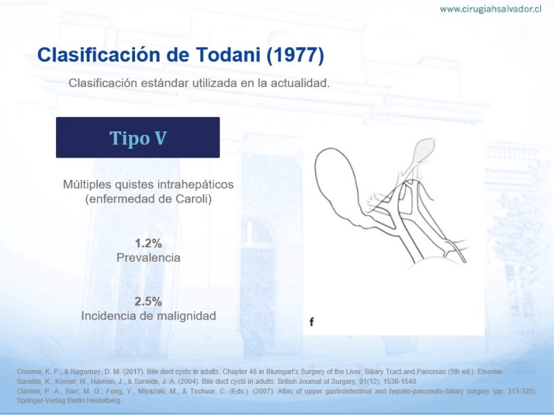 Diapositiva 6 de Quistes de Vía Biliar​