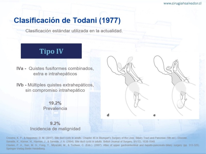 Diapositiva 5 de Quistes de Vía Biliar​
