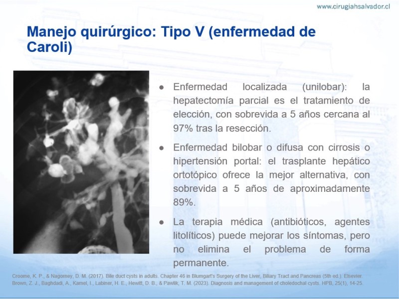 Diapositiva 19 de Quistes de Vía Biliar​