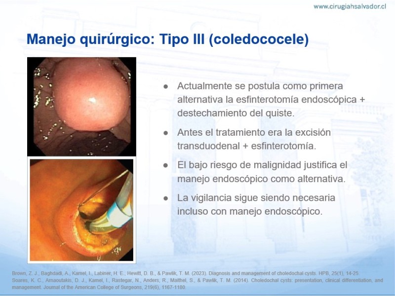 Diapositiva 17 de Quistes de Vía Biliar​