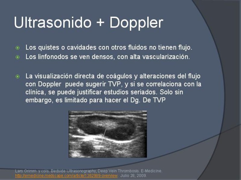 Diapositiva 15 de Ultrasonido de EEII en el diagnóstico de TVP
