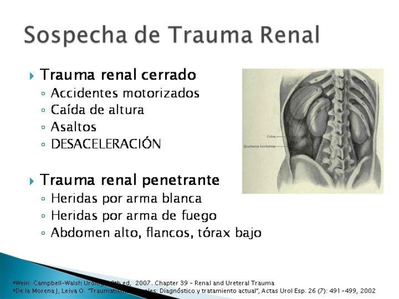 Diapositiva 4 de Trauma renal