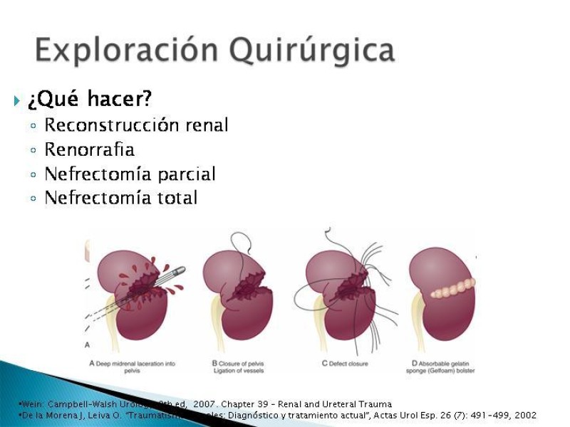 Diapositiva 16 de Trauma renal