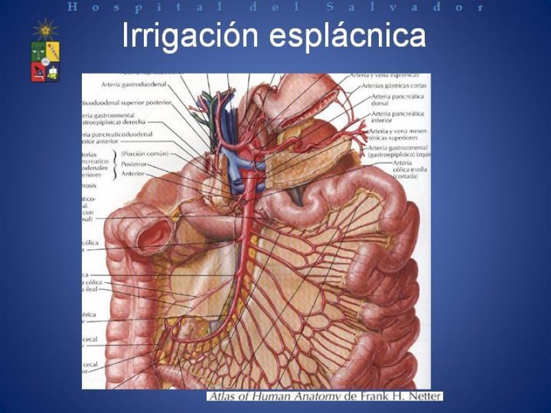 Diapositiva 11 de Isquemia Mesentérica Aguda