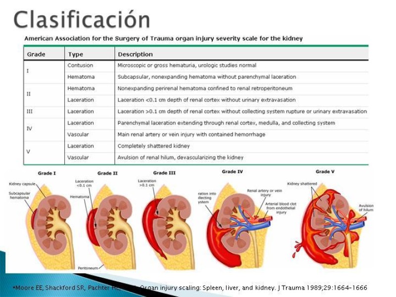 Diapositiva 8 de Trauma renal