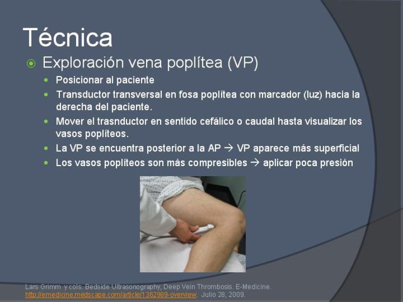 Diapositiva 11 de Ultrasonido de EEII en el diagnóstico de TVP