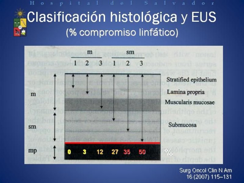 Diapositiva 13 de Mucosectomía Endoscópica en Cáncer Esofágico Superficial y Rol de la Endosonografía