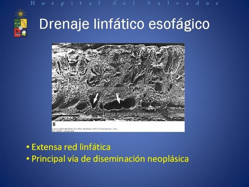 Diapositiva 2 de Mucosectomía Endoscópica en Cáncer Esofágico Superficial y Rol de la Endosonografía