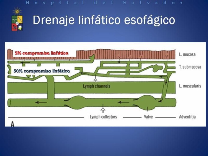 Diapositiva 3 de Mucosectomía Endoscópica en Cáncer Esofágico Superficial y Rol de la Endosonografía