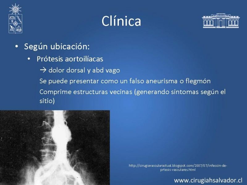 Diapositiva 9 de Infección de prótesis vasculares 