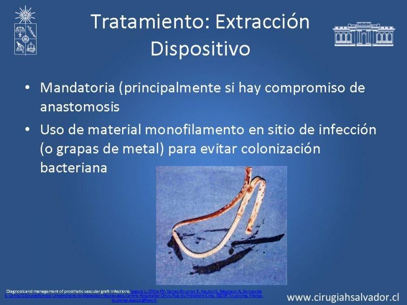 Diapositiva 15 de Infección de prótesis vasculares 