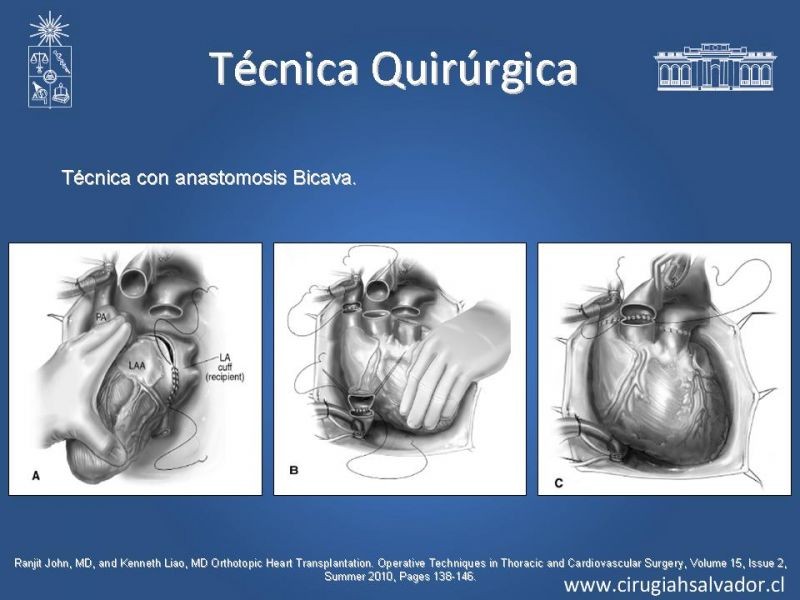 Diapositiva 23 de Trasplante Cardiaco