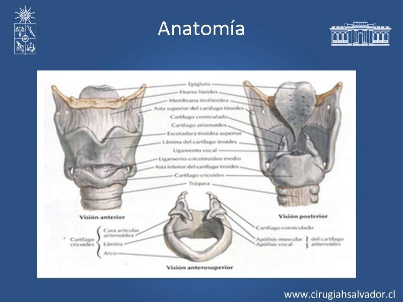 Diapositiva 4 de Cáncer Laríngeo