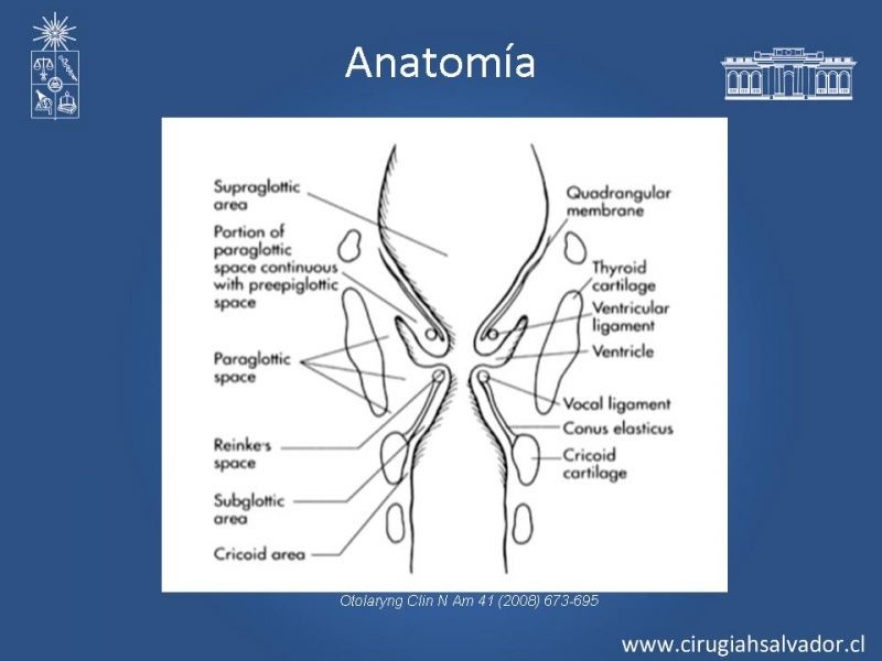 Diapositiva 6 de Cáncer Laríngeo