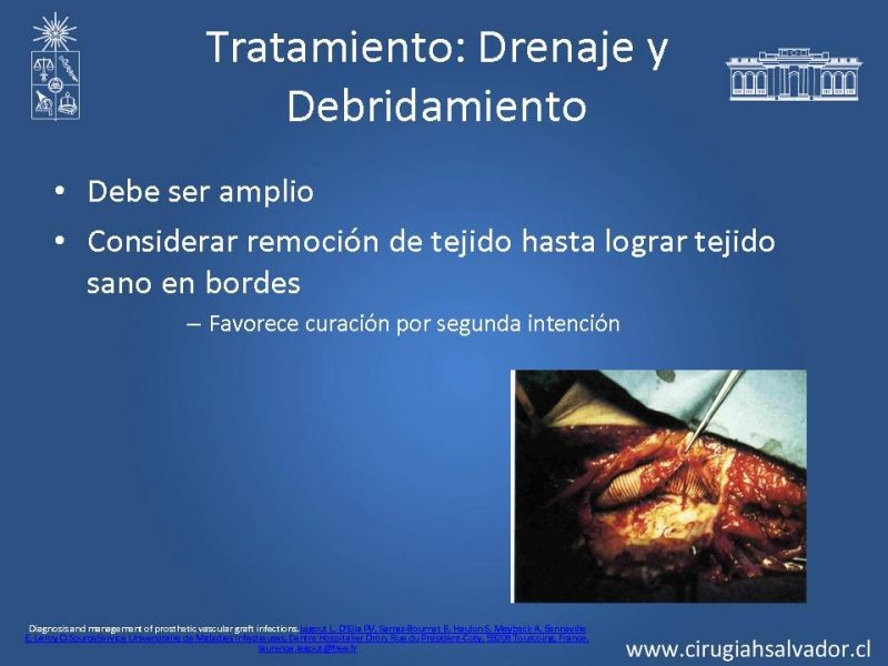 Diapositiva 16 de Infección de prótesis vasculares 
