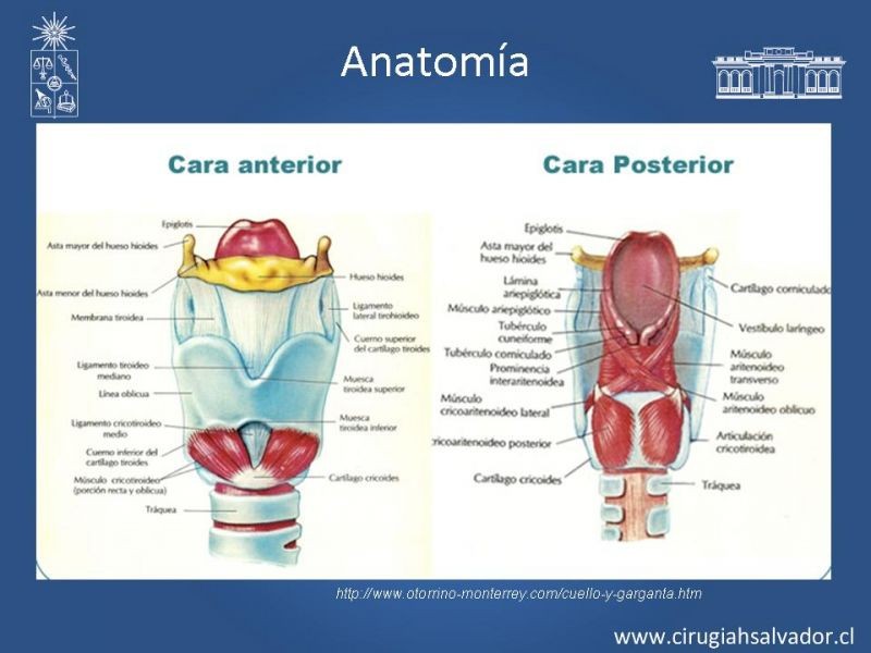 Diapositiva 5 de Cáncer Laríngeo