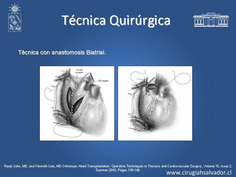 Diapositiva 24 de Trasplante Cardiaco