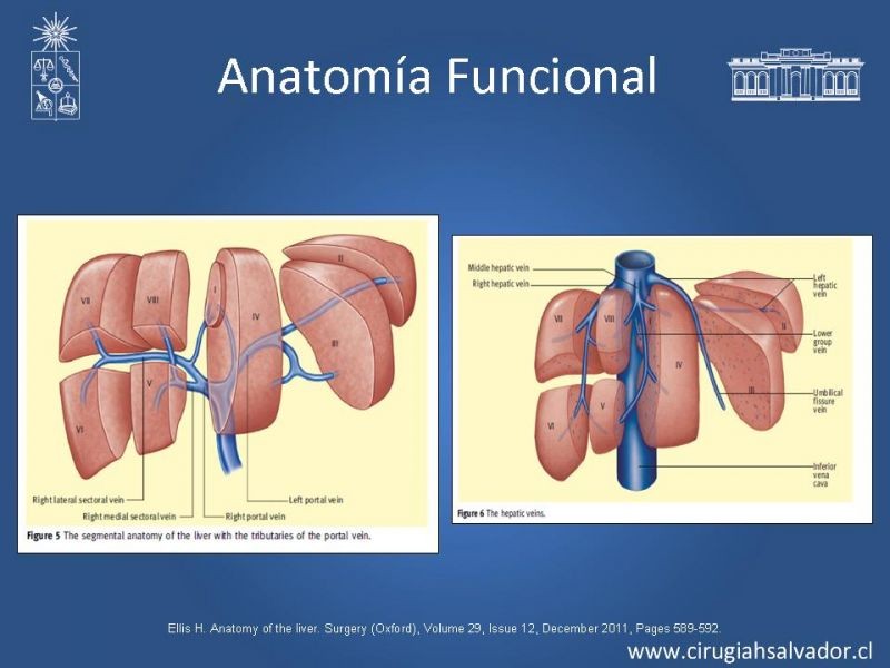 Diapositiva 9 de Segmentos Hepáticos: TC
