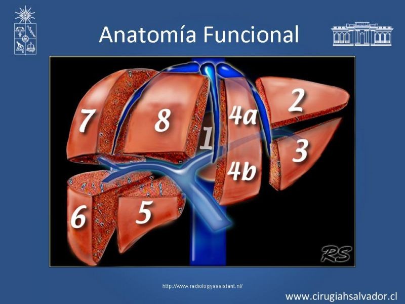 Diapositiva 7 de Segmentos Hepáticos: TC