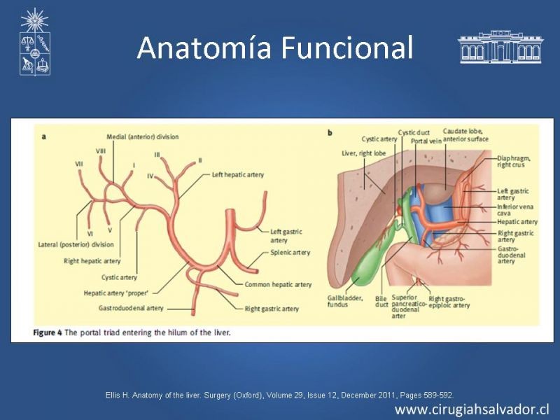 Diapositiva 10 de Segmentos Hepáticos: TC