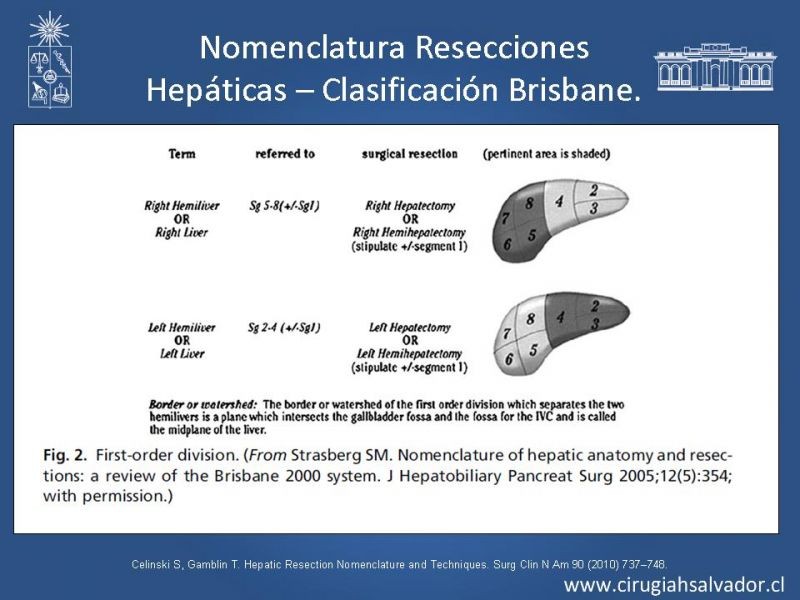 Diapositiva 17 de Segmentos Hepáticos: TC