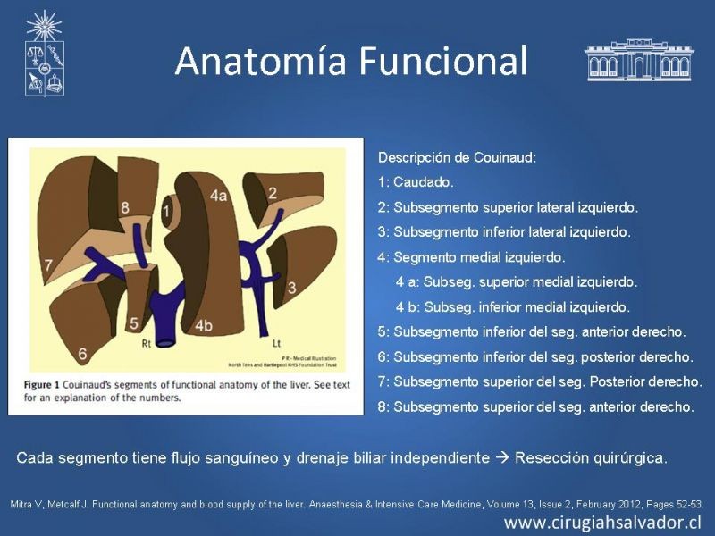 Diapositiva 8 de Segmentos Hepáticos: TC