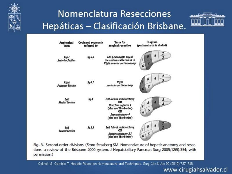 Diapositiva 18 de Segmentos Hepáticos: TC