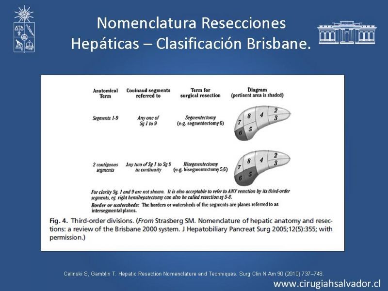 Diapositiva 19 de Segmentos Hepáticos: TC