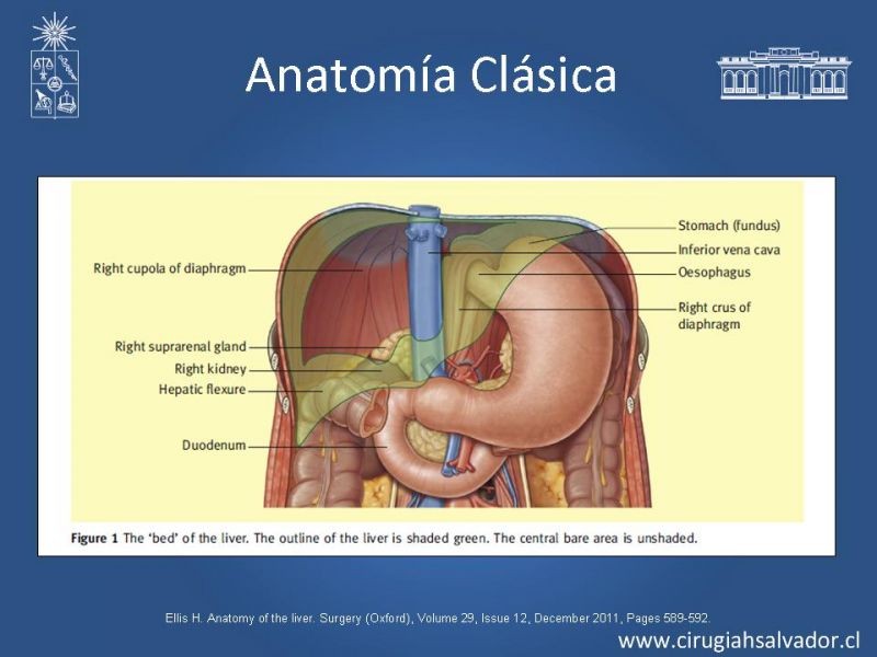 Diapositiva 3 de Segmentos Hepáticos: TC