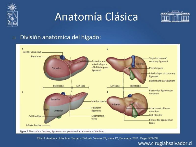 Diapositiva 4 de Segmentos Hepáticos: TC