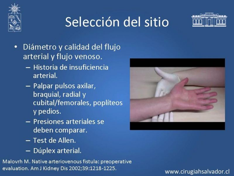 Diapositiva 4 de Accesos vasculares para hemodiálisis