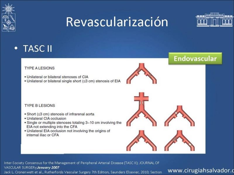 Diapositiva 11 de Tratamiento Actual de la Isquemia crítica EEII