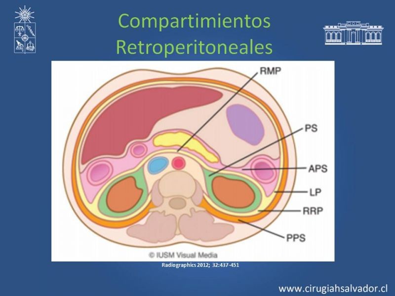 Diapositiva 35 de Anatomía Peritoneal y Retroperitoneal