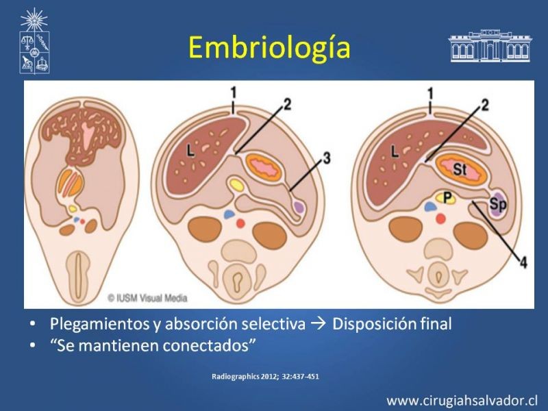 Diapositiva 5 de Anatomía Peritoneal y Retroperitoneal