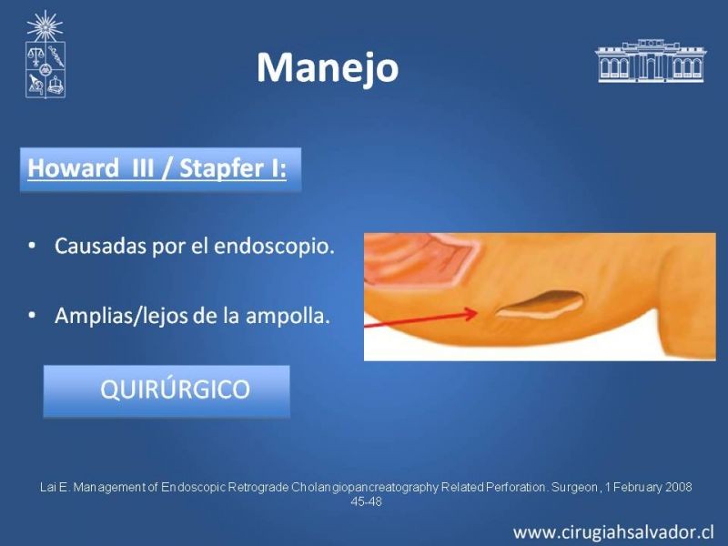 Diapositiva 20 de Perforación post ERCP