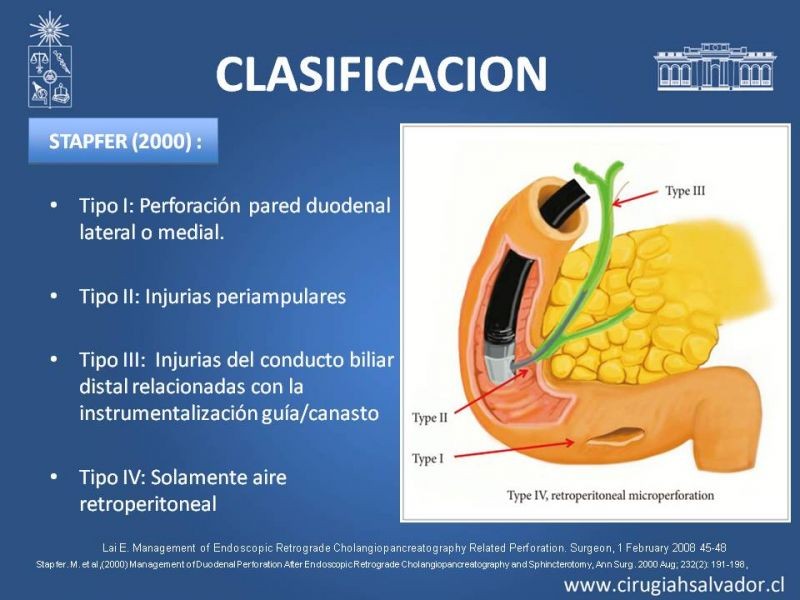 Diapositiva 17 de Perforación post ERCP