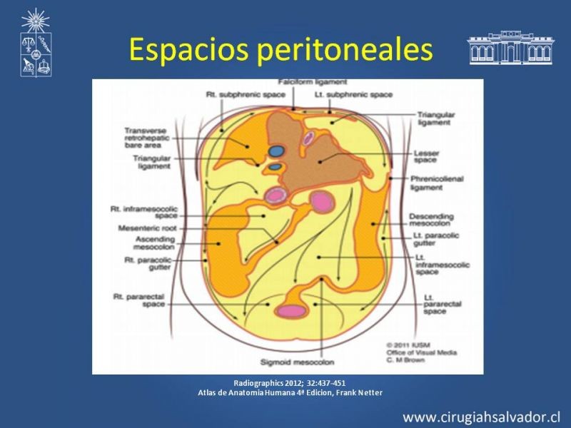 Diapositiva 24 de Anatomía Peritoneal y Retroperitoneal