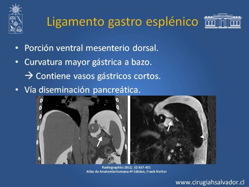 Diapositiva 14 de Anatomía Peritoneal y Retroperitoneal