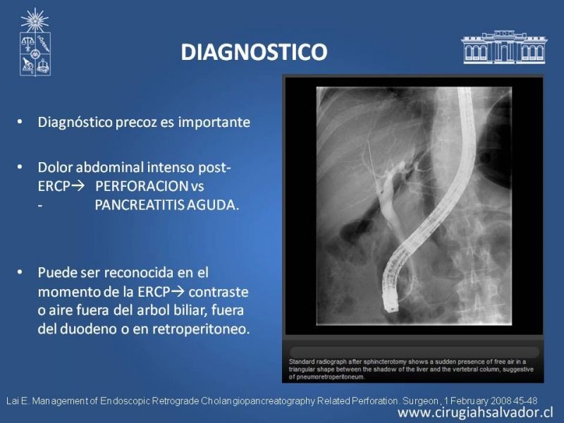 Diapositiva 10 de Perforación post ERCP
