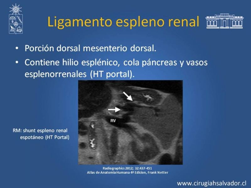 Diapositiva 16 de Anatomía Peritoneal y Retroperitoneal