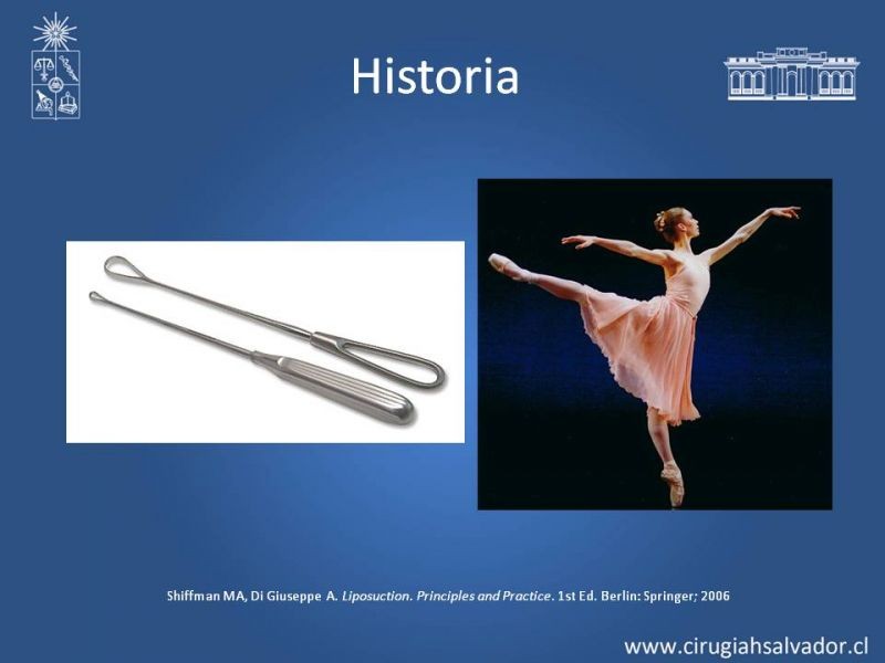 Diapositiva 1 de Liposucción