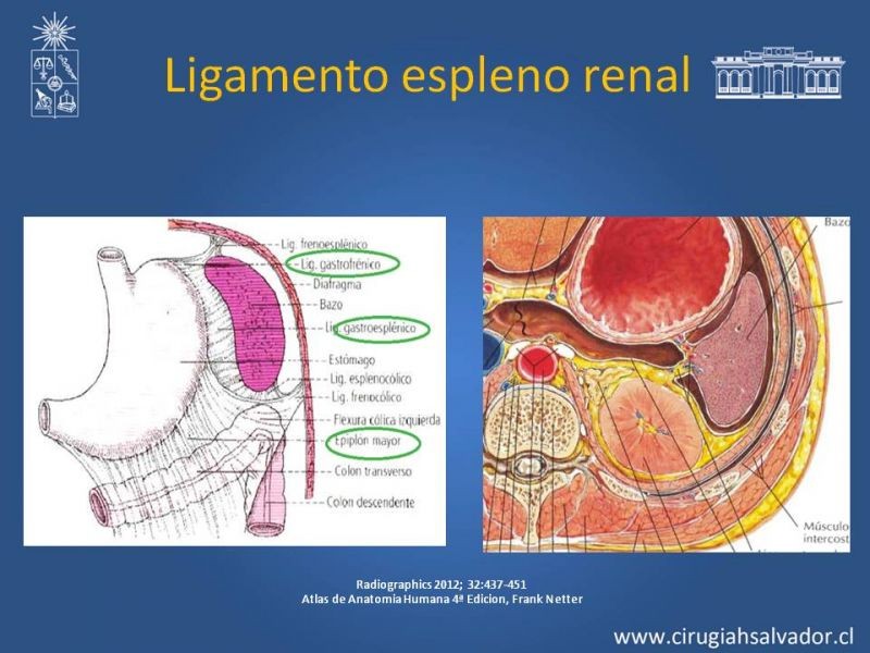 Diapositiva 17 de Anatomía Peritoneal y Retroperitoneal