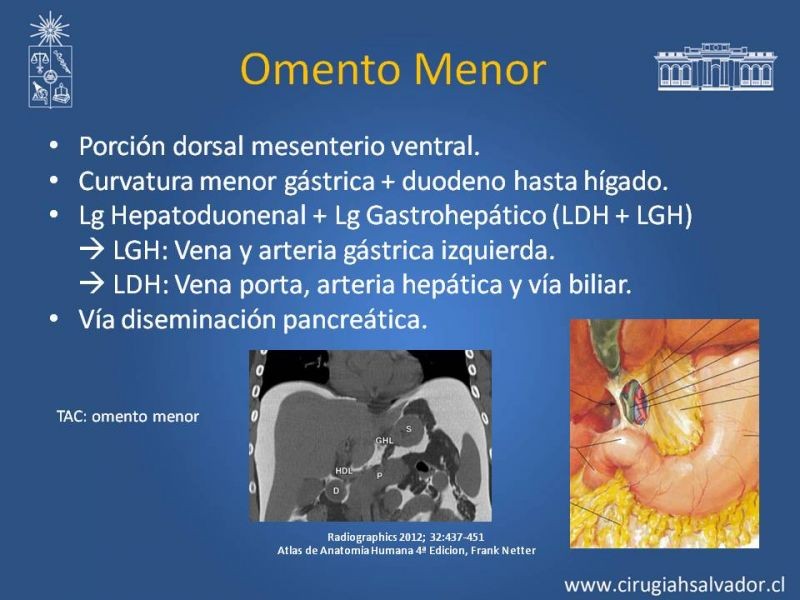 Diapositiva 12 de Anatomía Peritoneal y Retroperitoneal