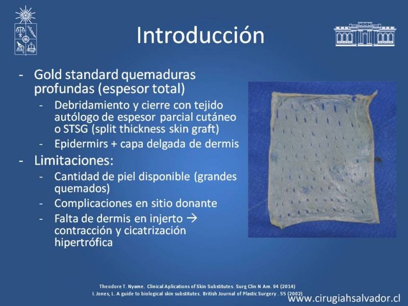 Diapositiva 5 de Sustitutos Dérmicos