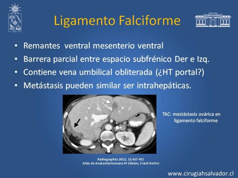 Diapositiva 10 de Anatomía Peritoneal y Retroperitoneal