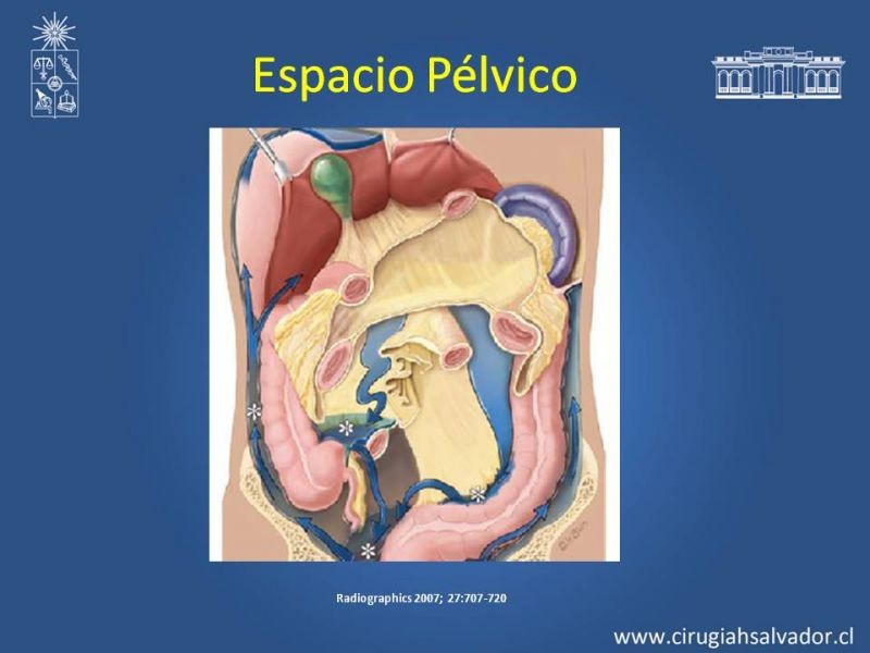 Diapositiva 33 de Anatomía Peritoneal y Retroperitoneal