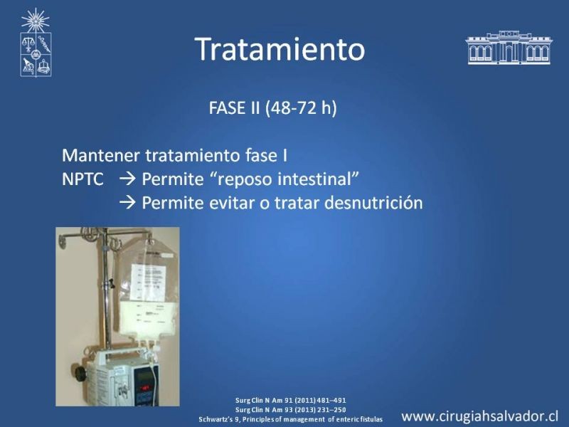 Diapositiva 12 de Fístulas Intestinales
