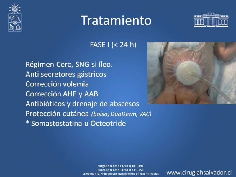 Diapositiva 11 de Fístulas Intestinales