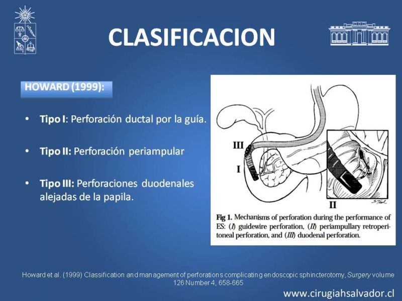 Diapositiva 16 de Perforación post ERCP